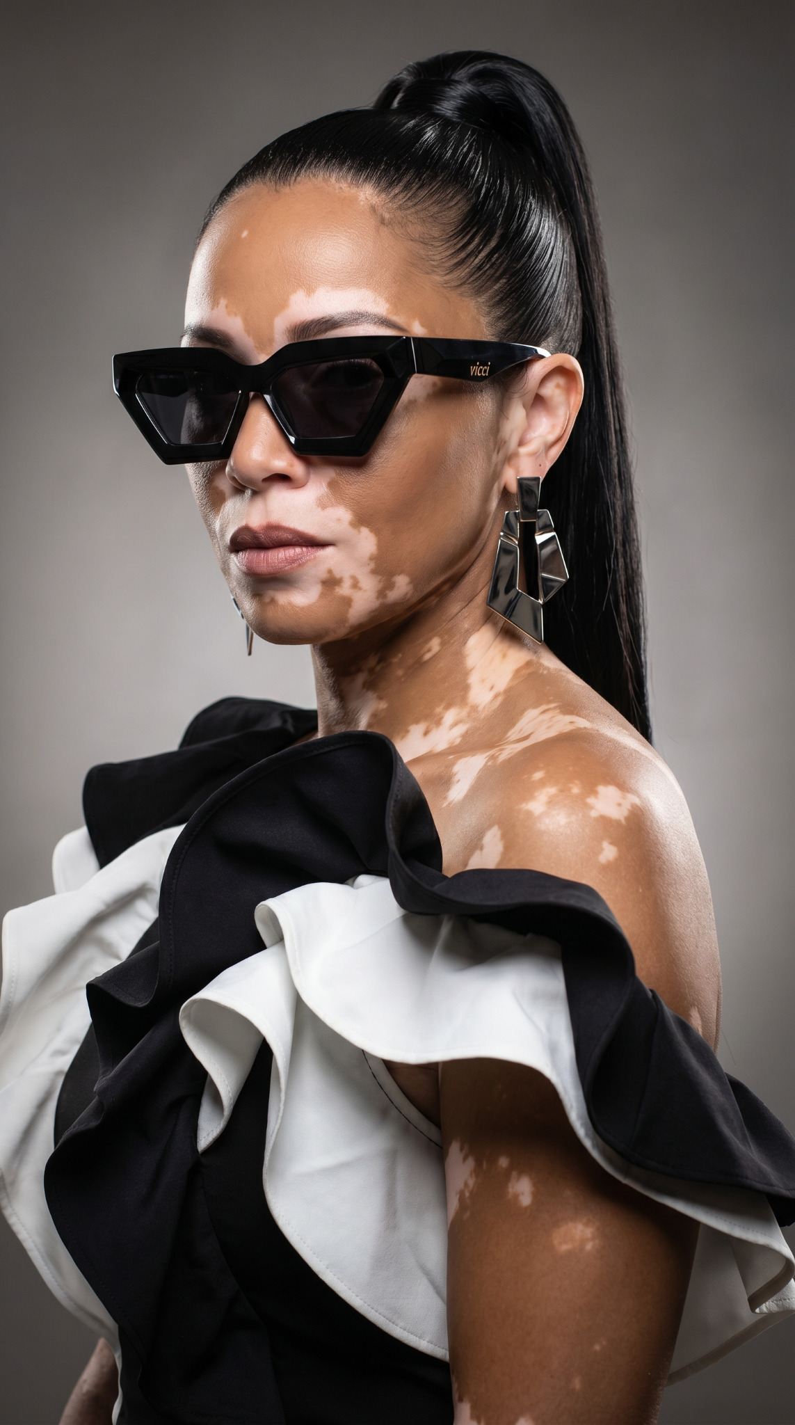 Editorial fashion portrait — vitiligo couture